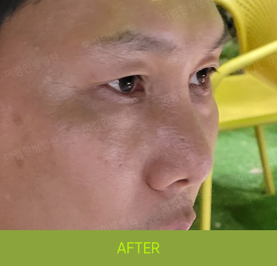 �Խñ� �����