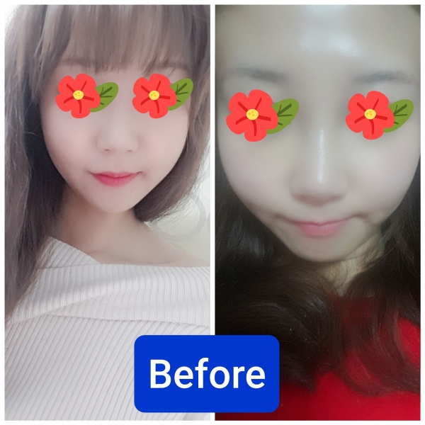 �����丮 �����
