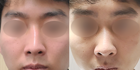 �����丮 �����
