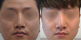 �����丮 �����