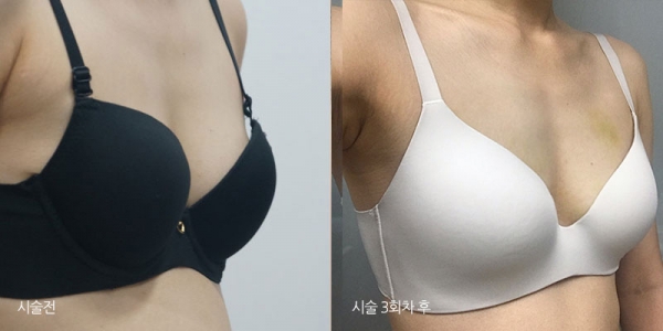 �����丮 �����