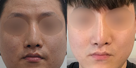 �����丮 �����
