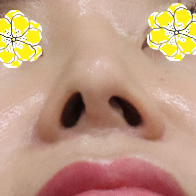 �����丮 �����