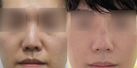 �����丮 �����